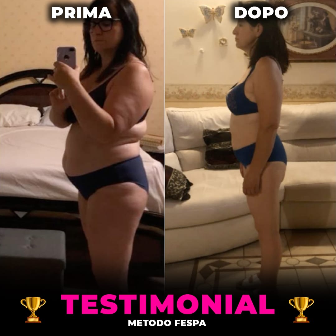 Real FESPA Method result: before and after photo