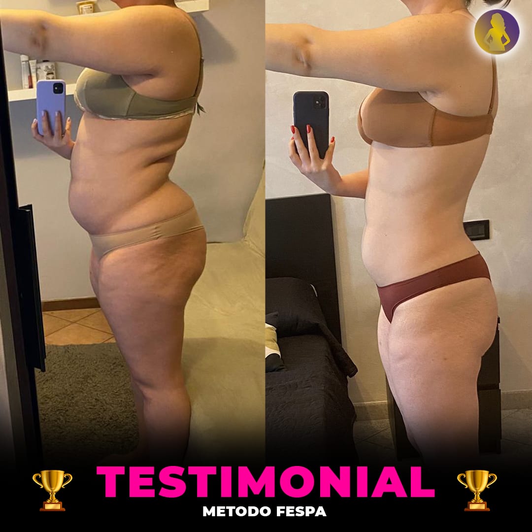 Real FESPA Method result: before and after photo