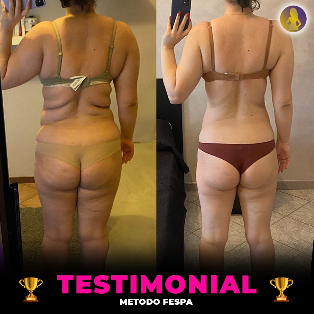 Real FESPA Method result: before and after photo